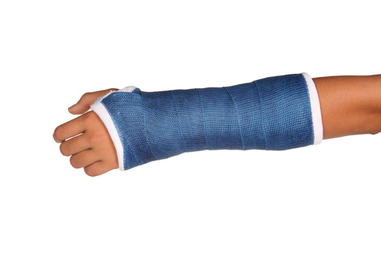Casting Services | Sydney Orthopaedic Physiotherapy